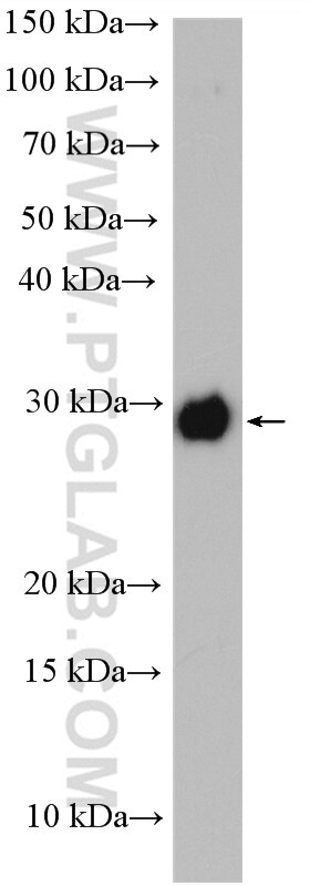 Western Blot (WB) analysis of rat testis tissue using PCMT1 Polyclonal antibody (10519-1-AP)