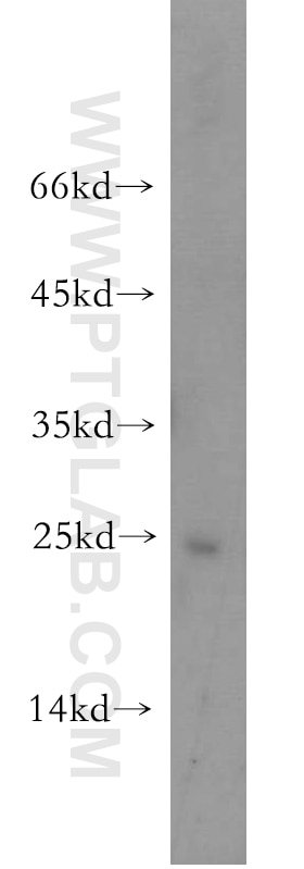 PCMT1