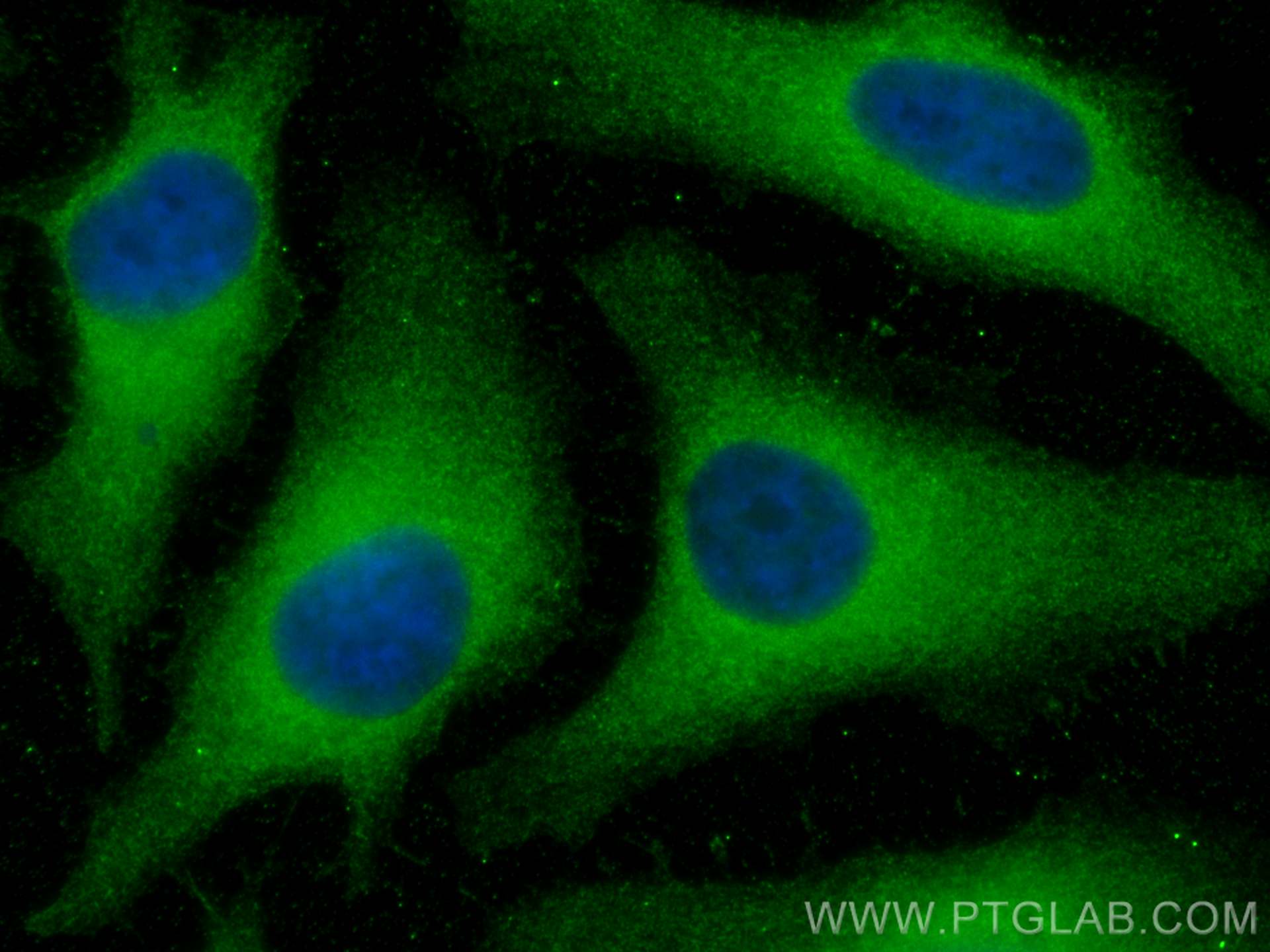 Immunofluorescence (IF) / fluorescent staining of HeLa cells using PCMT1 Monoclonal antibody (60172-1-Ig)