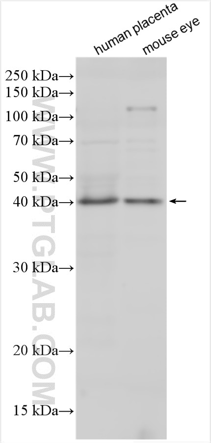 Western Blot (WB) analysis of various lysates using PCMTD1 Polyclonal antibody (24425-1-AP)