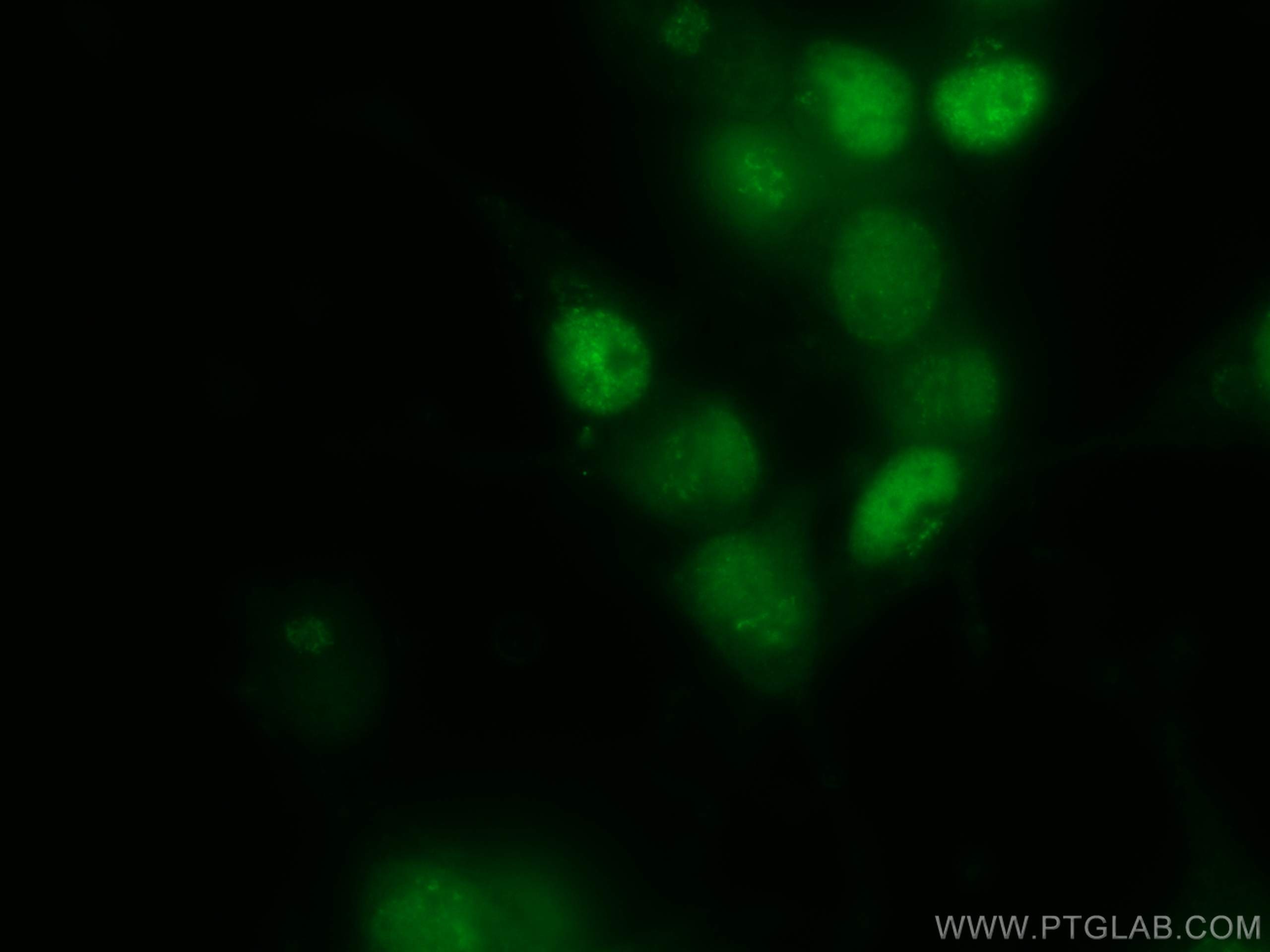 Immunofluorescence (IF) / fluorescent staining of Neuro-2a cells using PCNA Polyclonal antibody (10205-2-AP)