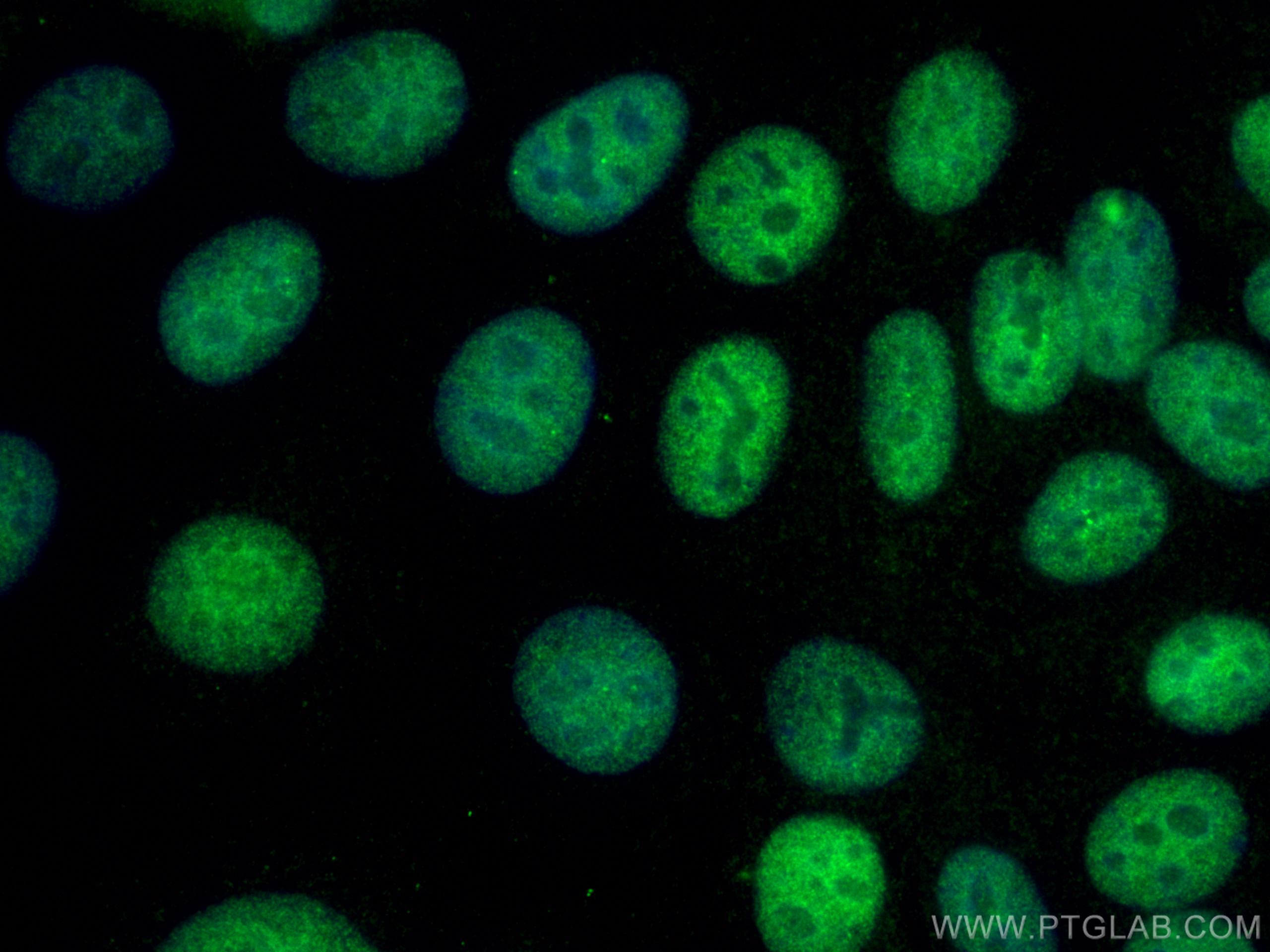 Immunofluorescence (IF) / fluorescent staining of MCF-7 cells using PCNA Polyclonal antibody (10205-2-AP)