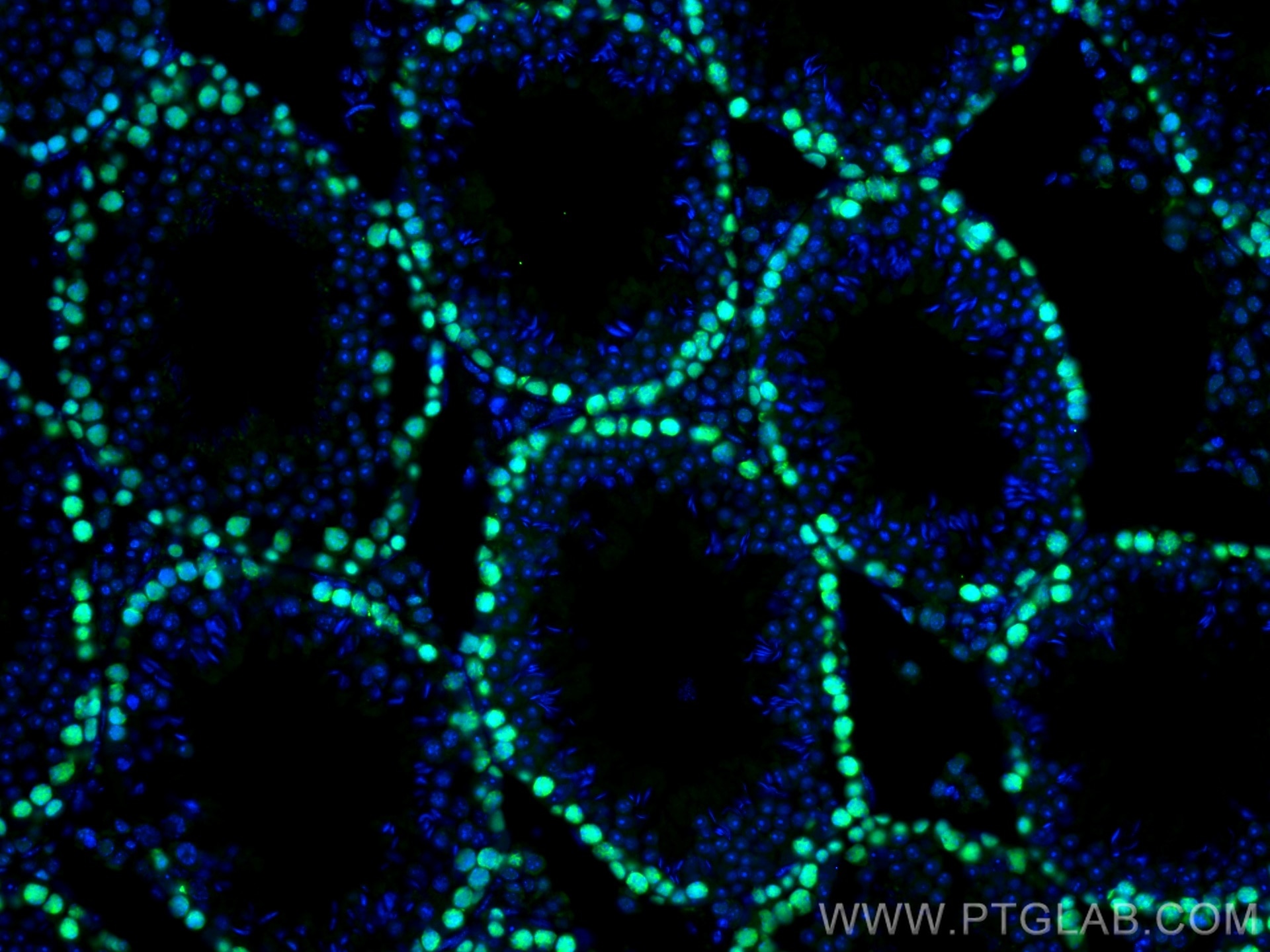 Immunofluorescence (IF) / fluorescent staining of mouse testis tissue using PCNA Polyclonal antibody (10205-2-AP)