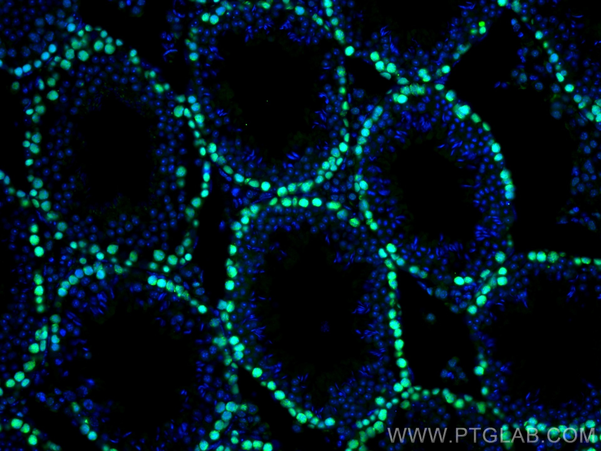 IF Staining of mouse testis using 10205-2-AP