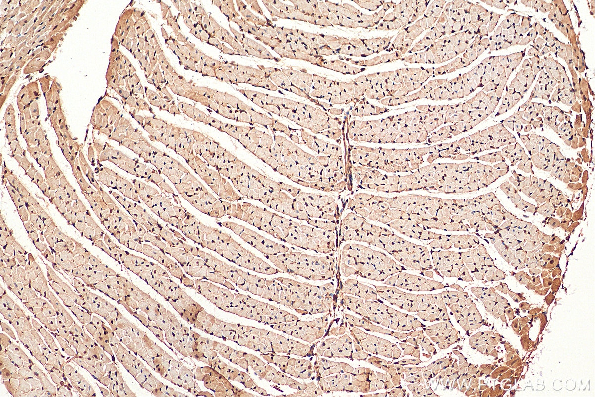 IHC staining of mouse heart using 10205-2-AP