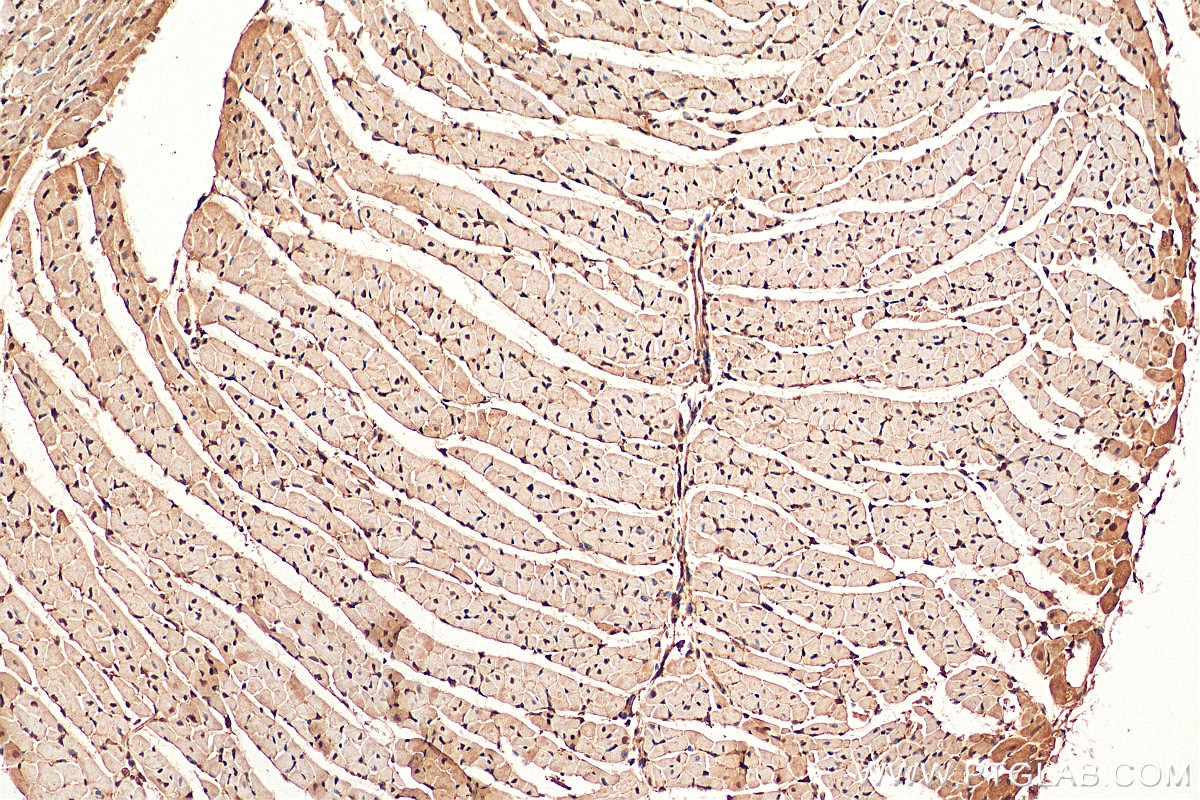 Immunohistochemistry (IHC) staining of mouse heart tissue using PCNA Polyclonal antibody (10205-2-AP)