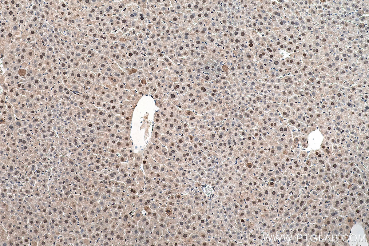 Immunohistochemistry (IHC) staining of mouse liver tissue using PCNA Polyclonal antibody (10205-2-AP)