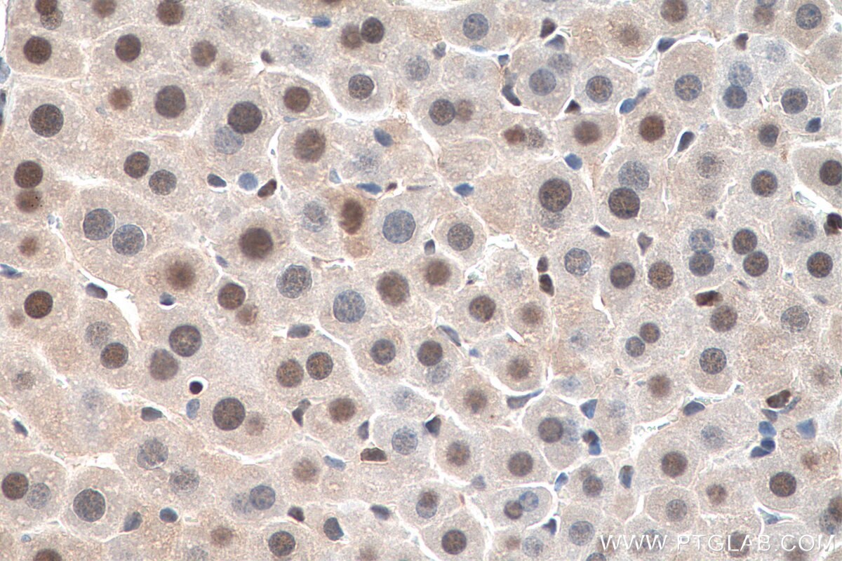 Immunohistochemistry (IHC) staining of mouse liver tissue using PCNA Polyclonal antibody (10205-2-AP)