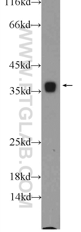 Western Blot (WB) analysis of rat liver tissue using PCNA Polyclonal antibody (10205-2-AP)