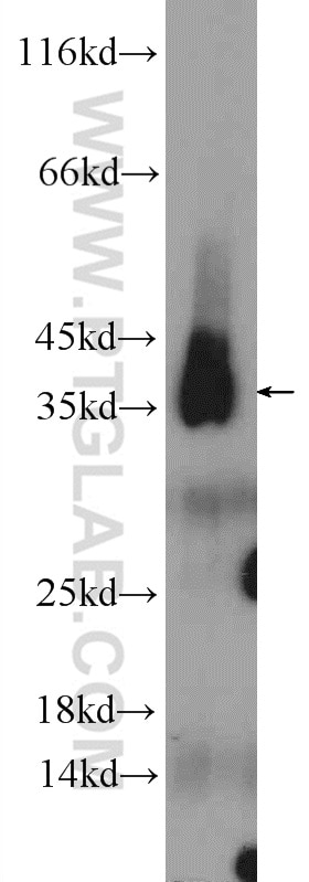 Western Blot (WB) analysis of rat testis tissue using PCNA Polyclonal antibody (10205-2-AP)