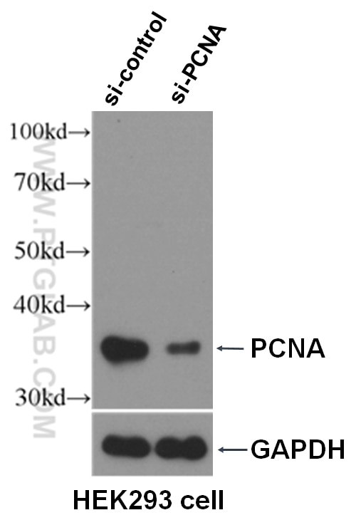 Western Blot (WB) analysis of HEK293 cells using PCNA Polyclonal antibody (10205-2-AP)