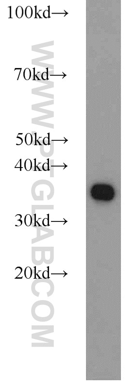 Western Blot (WB) analysis of A431 cells using PCNA Polyclonal antibody (10205-2-AP)