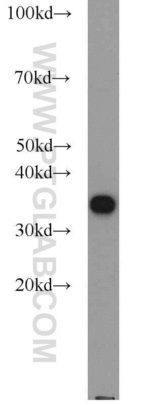 Western Blot (WB) analysis of NIH/3T3 cells using PCNA Polyclonal antibody (10205-2-AP)