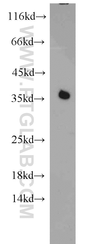 Western Blot (WB) analysis of HepG2 cells using PCNA Polyclonal antibody (10205-2-AP)