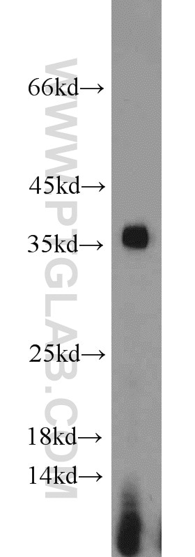 Western Blot (WB) analysis of mouse testis tissue using PCNA Polyclonal antibody (10205-2-AP)