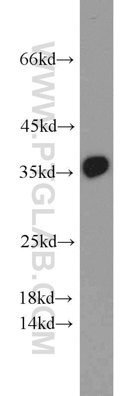 Western Blot (WB) analysis of Raji cells using PCNA Polyclonal antibody (10205-2-AP)