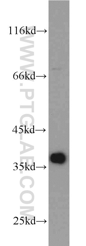 PCNA Polyclonal antibody