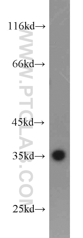 Western Blot (WB) analysis of mouse liver tissue using PCNA Polyclonal antibody (10205-2-AP)