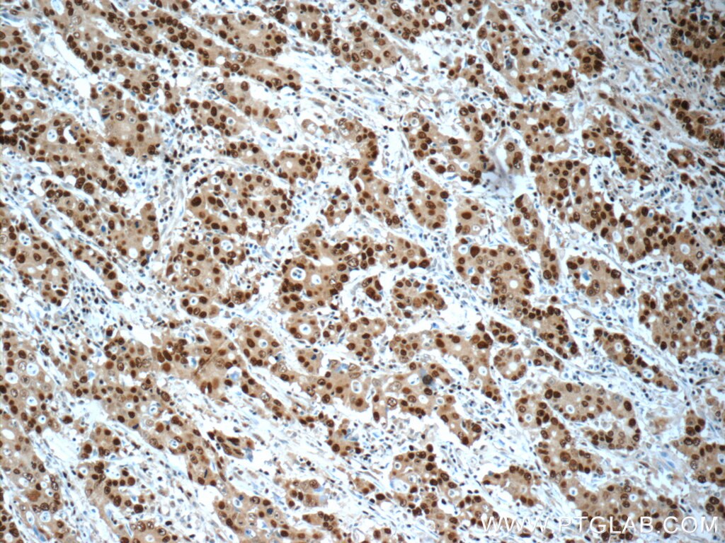 PCNA