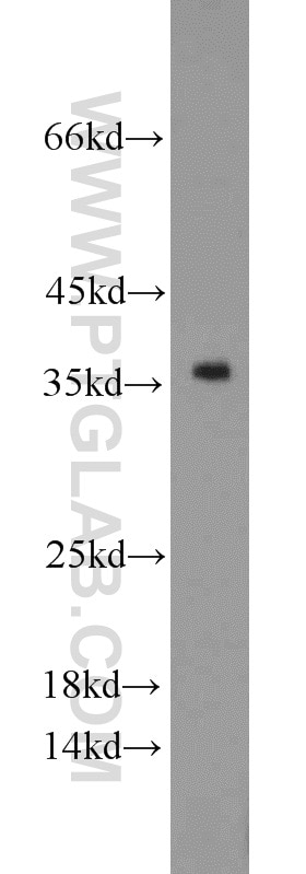 Western Blot (WB) analysis of mouse testis tissue using PCNA Polyclonal antibody (24036-1-AP)