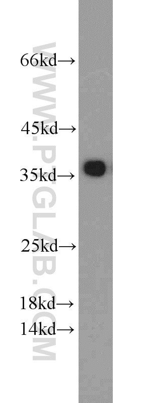 Western Blot (WB) analysis of Raji cells using PCNA Polyclonal antibody (24036-1-AP)