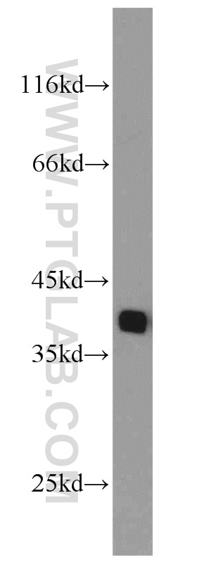 Western Blot (WB) analysis of HEK-293 cells using PCNA Polyclonal antibody (24036-1-AP)