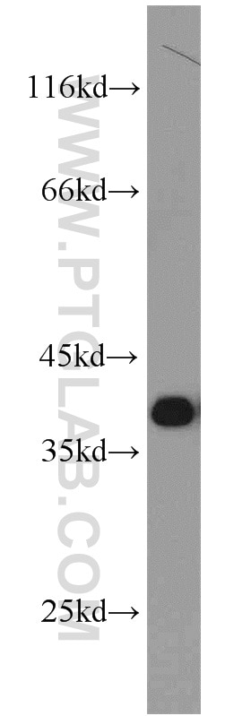 Western Blot (WB) analysis of NIH/3T3 cells using PCNA Polyclonal antibody (24036-1-AP)
