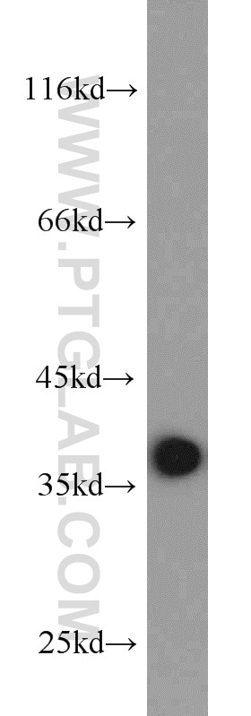 Western Blot (WB) analysis of MCF-7 cells using PCNA Polyclonal antibody (24036-1-AP)