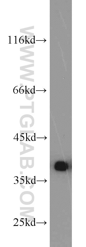 Western Blot (WB) analysis of MCF-7 cells using PCNA Polyclonal antibody (24036-1-AP)