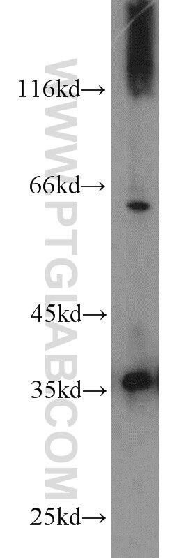 Western Blot (WB) analysis of rat liver tissue using PCNA Polyclonal antibody (24036-1-AP)