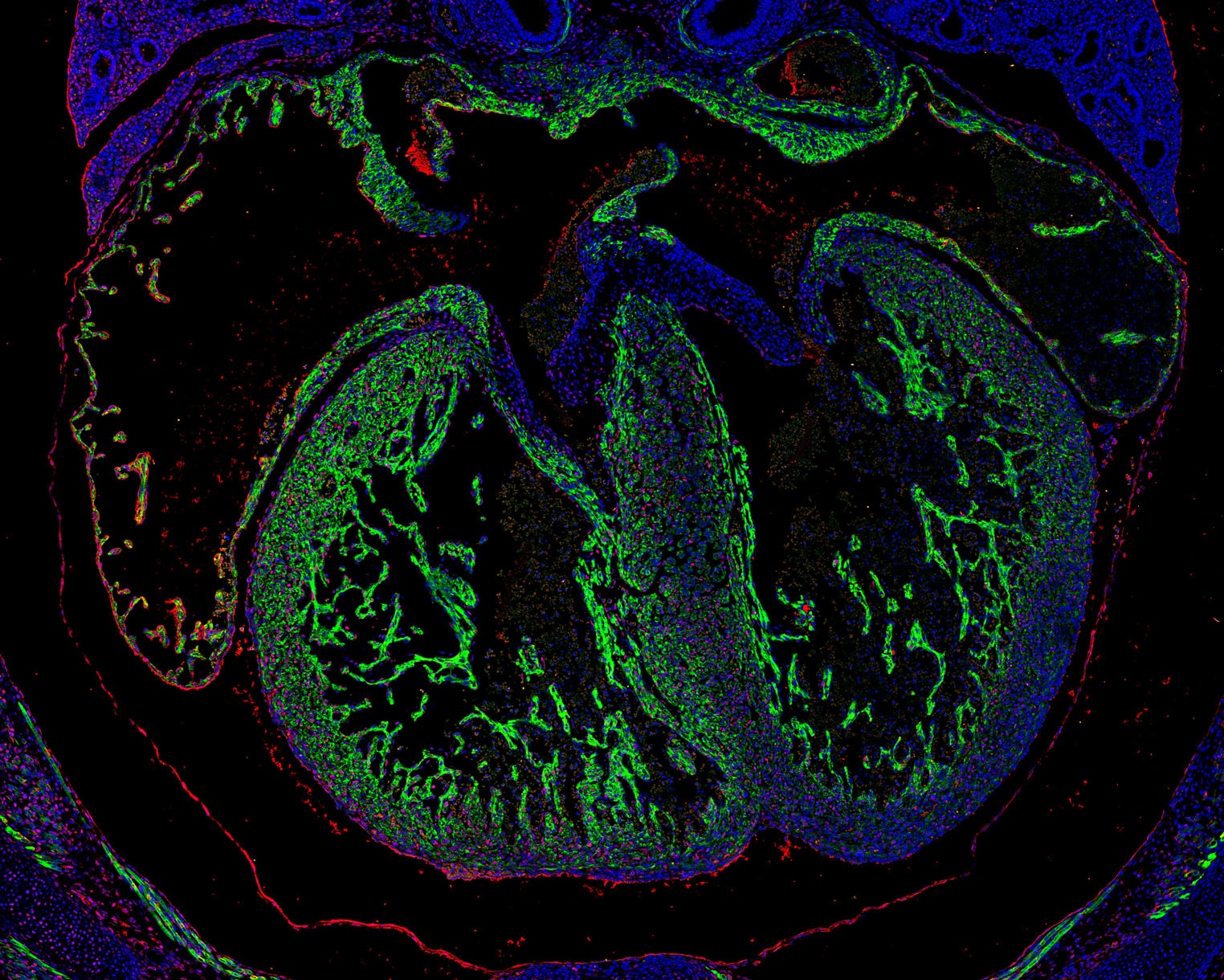 Immunofluorescence (IF) / fluorescent staining of mouse heart tissue using PCNA Monoclonal antibody (60097-1-Ig)