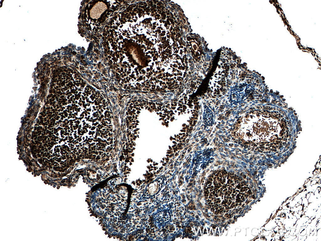 IHC staining of mouse ovary using 60097-1-Ig
