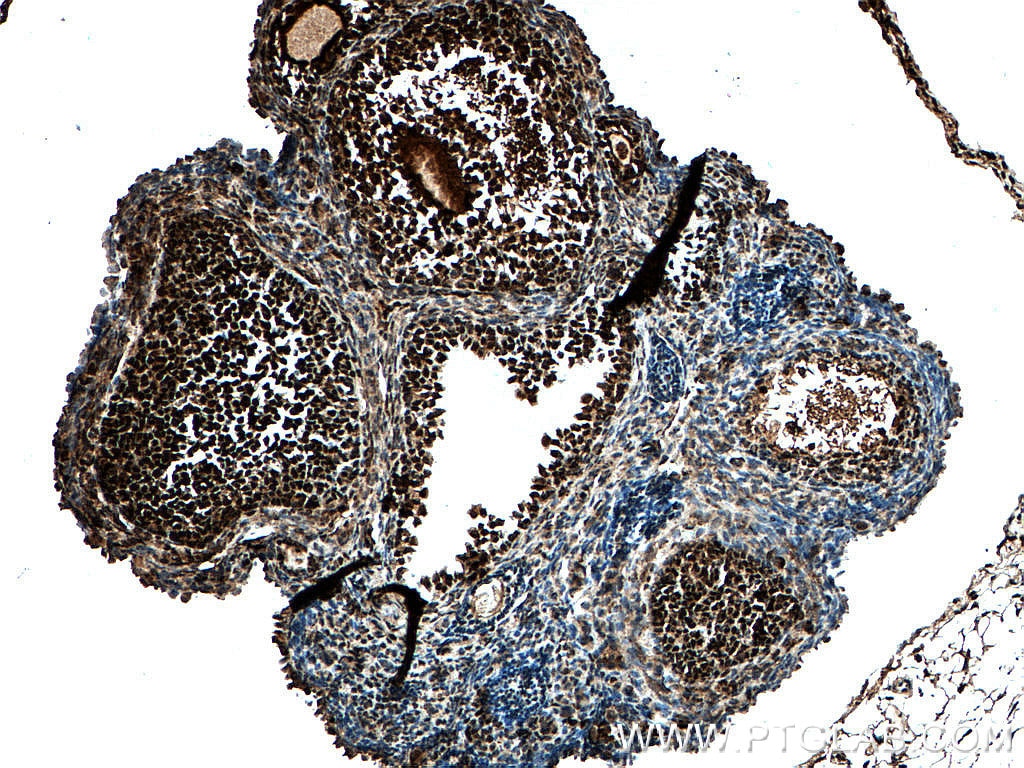 Immunohistochemistry (IHC) staining of mouse ovary tissue using PCNA Monoclonal antibody (60097-1-Ig)