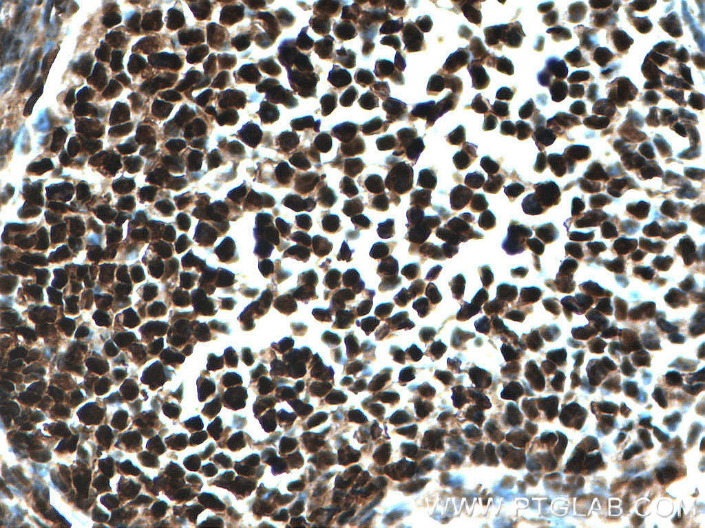 Immunohistochemistry (IHC) staining of mouse ovary tissue using PCNA Monoclonal antibody (60097-1-Ig)