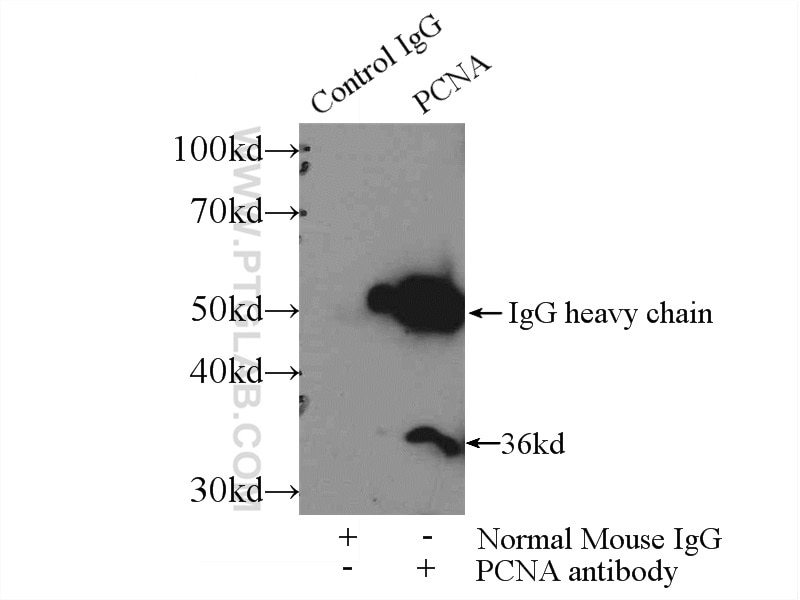 Immunoprecipitation (IP) experiment of HepG2 cells using PCNA Monoclonal antibody (60097-1-Ig)