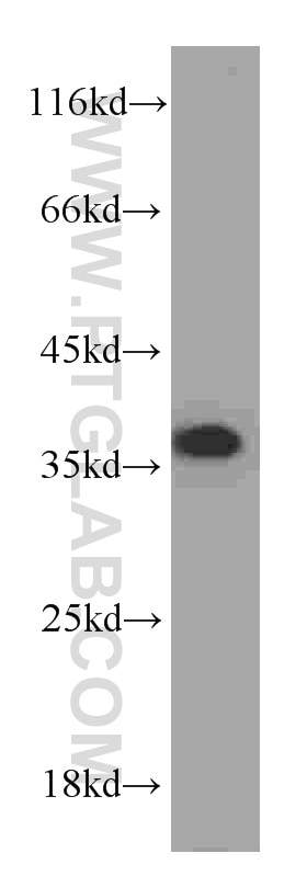 Western Blot (WB) analysis of HepG2 cells using PCNA Monoclonal antibody (60097-1-Ig)