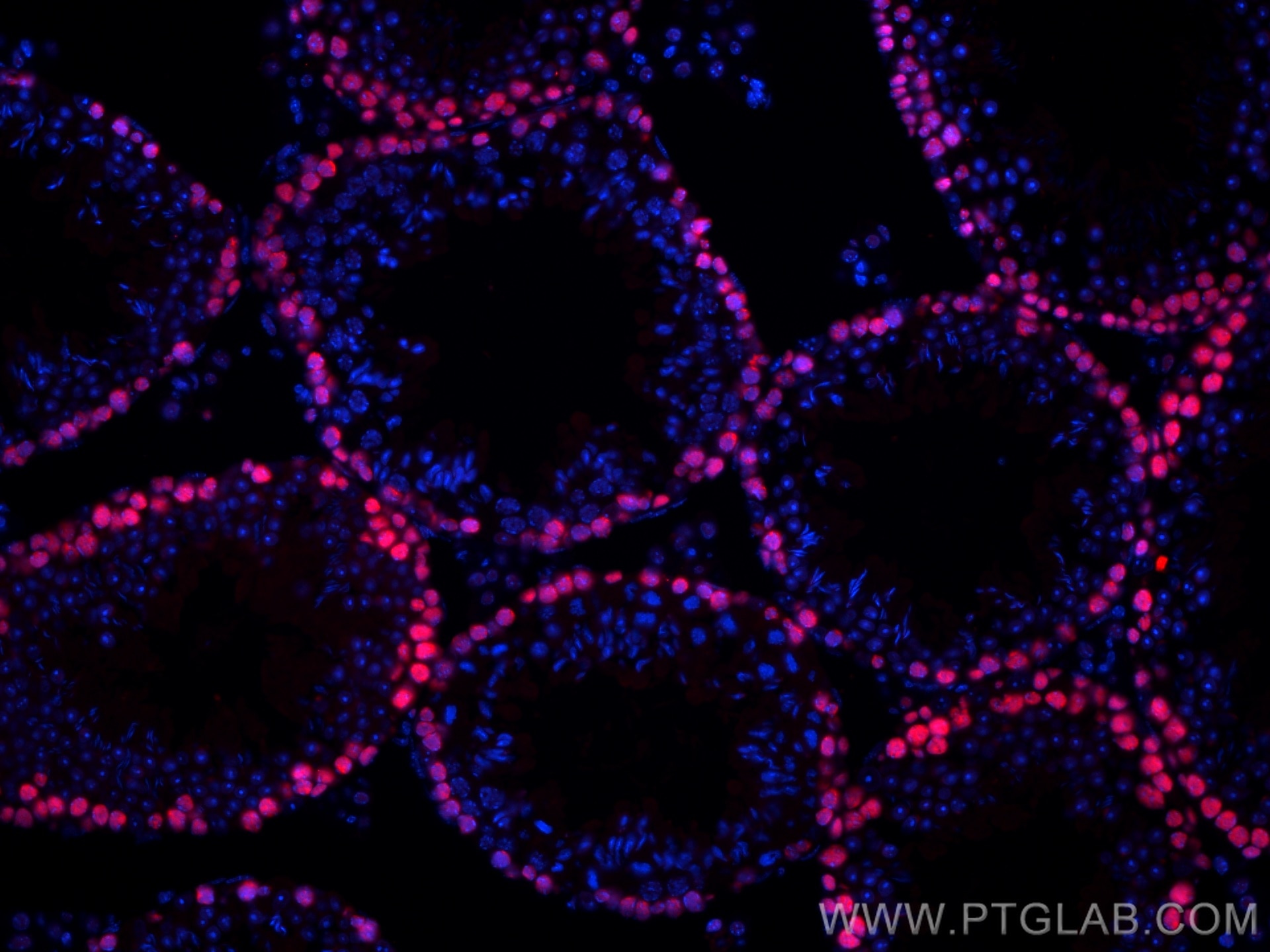 IF Staining of mouse testis using CL594-10205