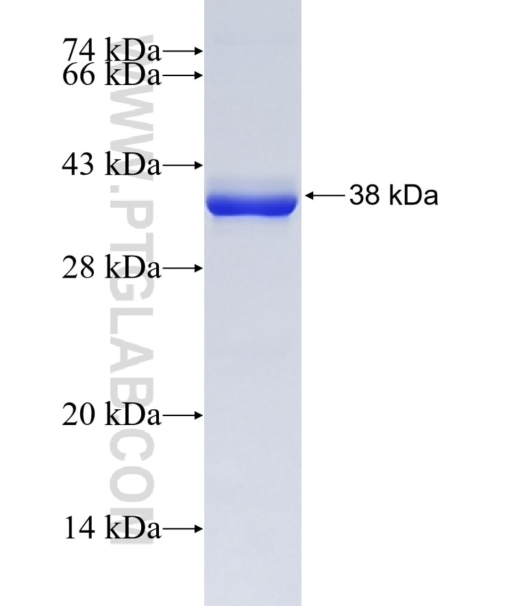 PCNA fusion protein Ag7416 SDS-PAGE
