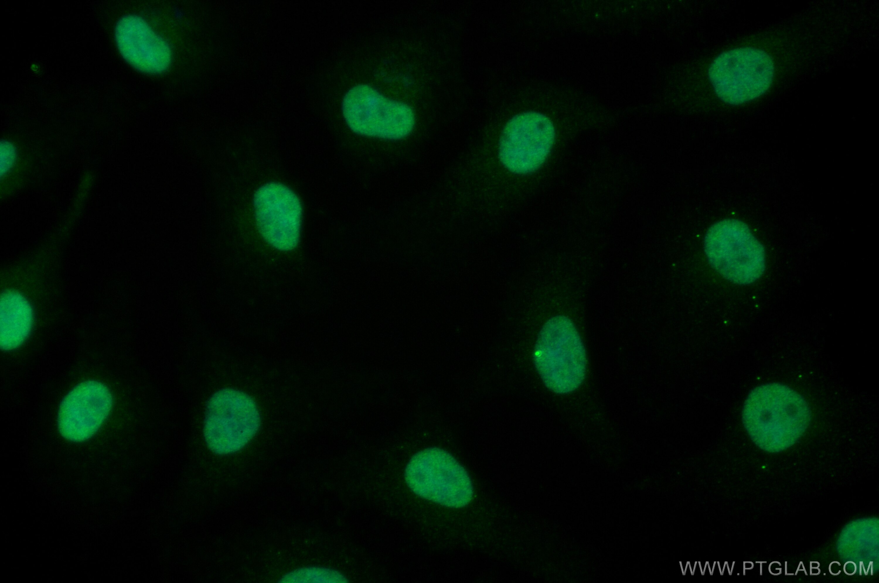 Immunofluorescence (IF) / fluorescent staining of HeLa cells using PCNP Polyclonal antibody (11180-2-AP)