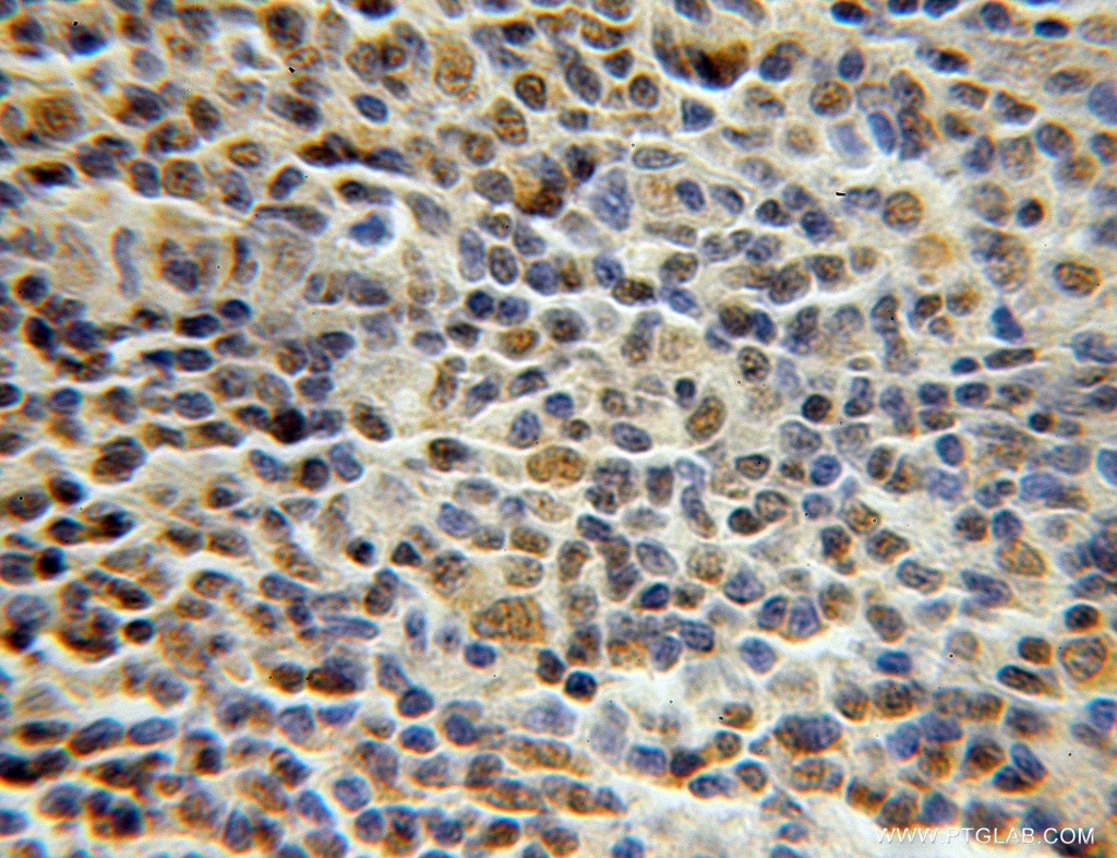 PCNP