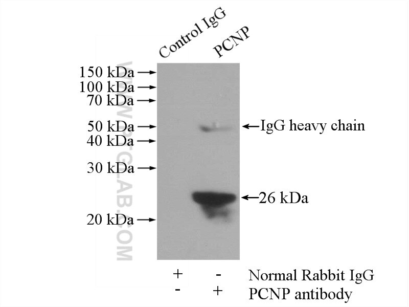 Immunoprecipitation (IP) experiment of HepG2 cells using PCNP Polyclonal antibody (11180-2-AP)