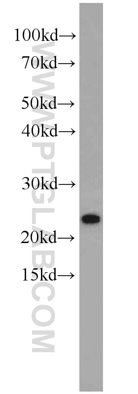 Western Blot (WB) analysis of HepG2 cells using PCNP Polyclonal antibody (11180-2-AP)