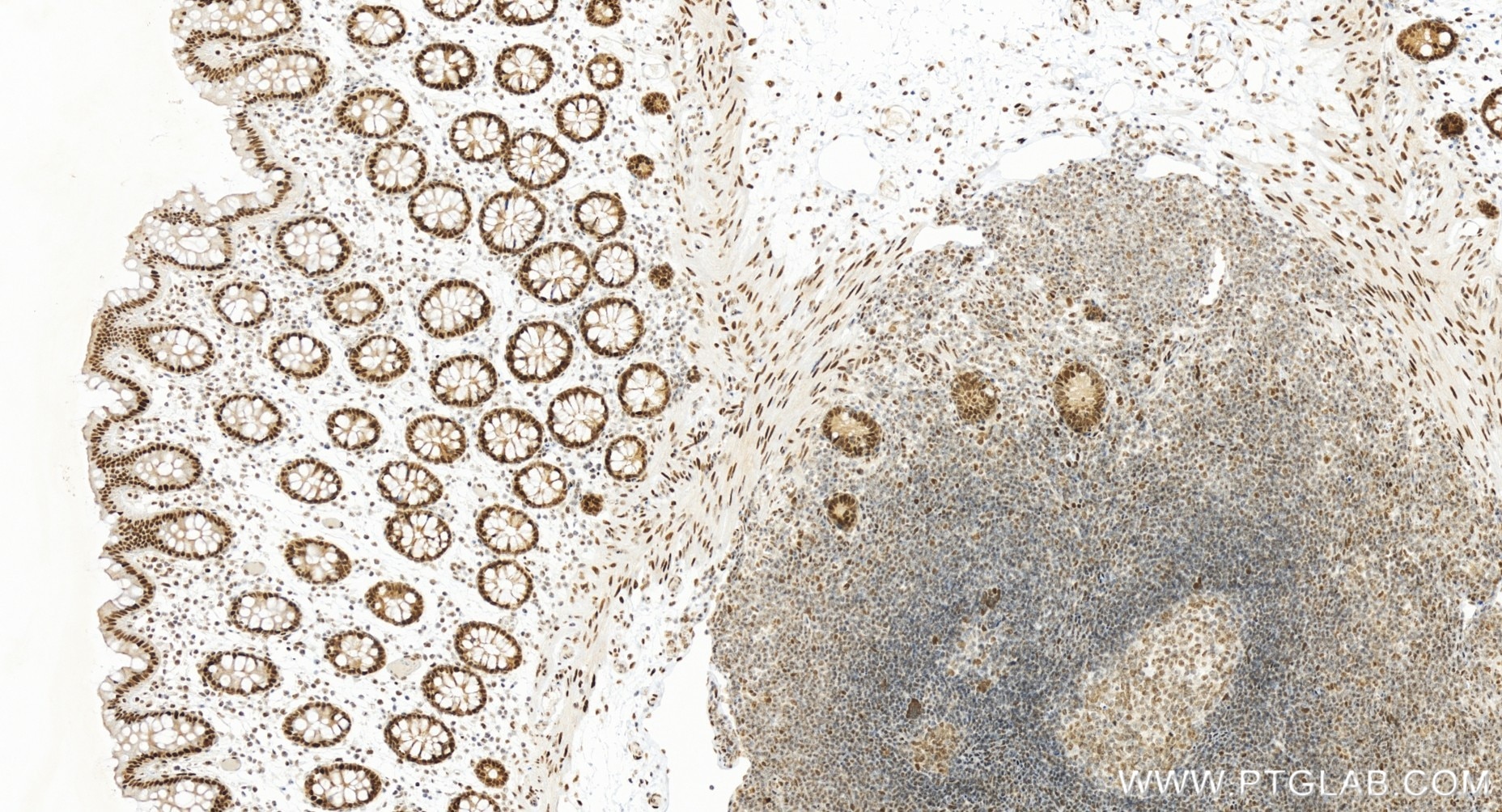 Immunohistochemistry (IHC) staining of human colon tissue using PCNP Recombinant antibody (86075-1-RR)