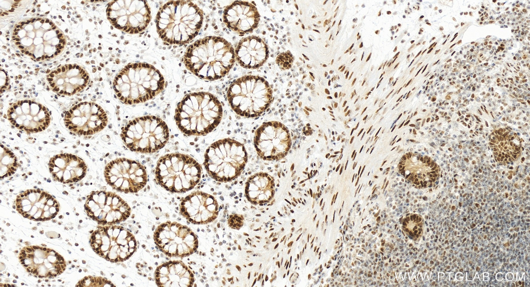 Immunohistochemistry (IHC) staining of human colon tissue using PCNP Recombinant antibody (86075-1-RR)