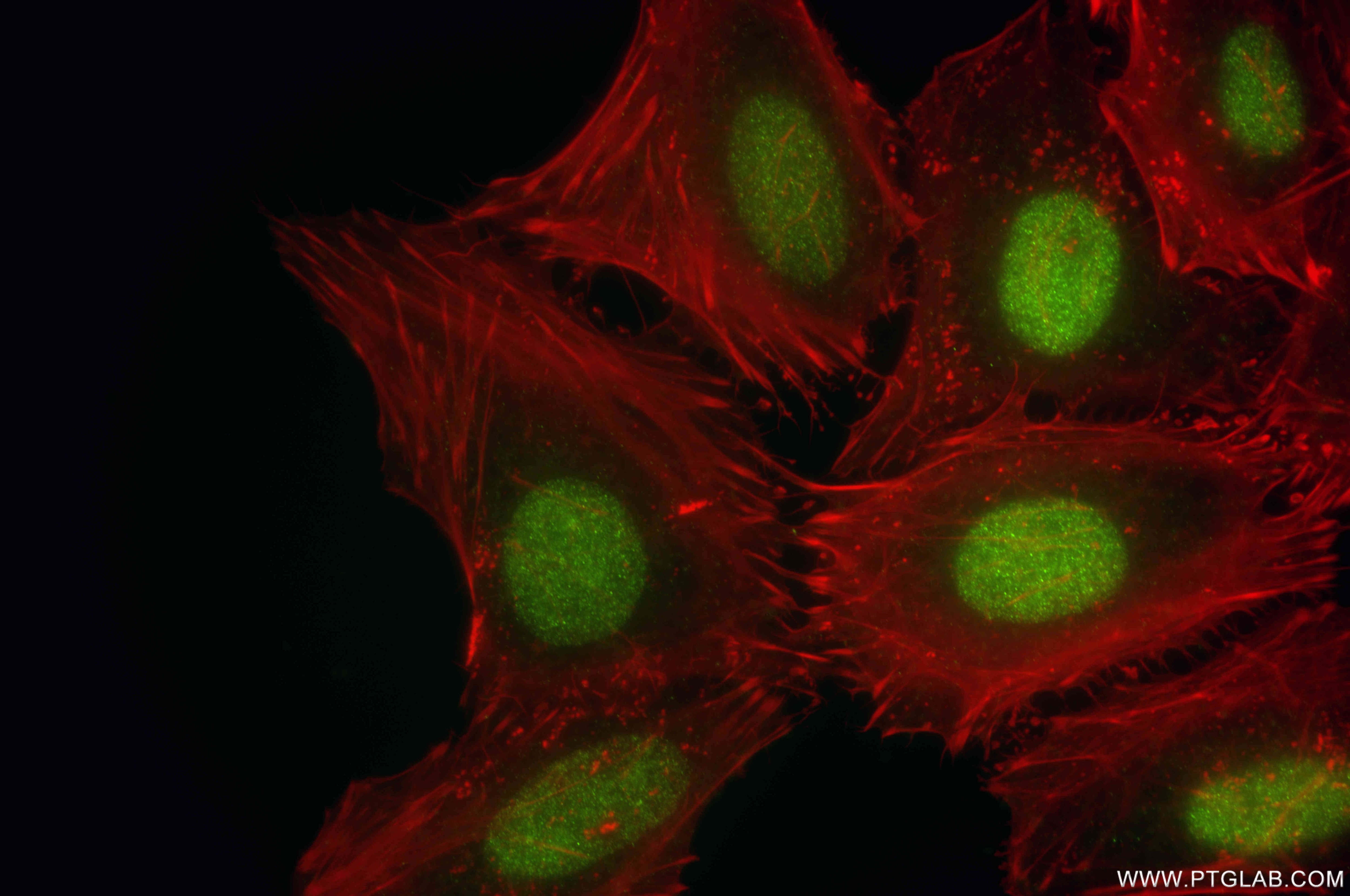 Immunofluorescence (IF) / fluorescent staining of HeLa cells using PCNP Recombinant antibody (86075-1-RR)