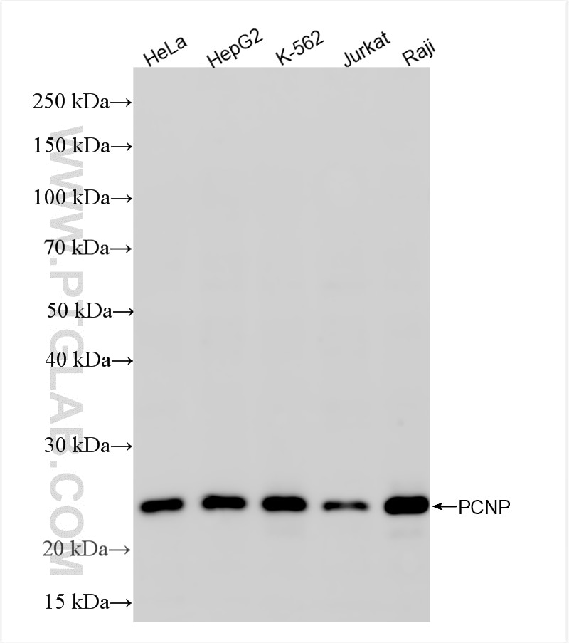 Western Blot (WB) analysis of various lysates using PCNP Recombinant antibody (86075-1-RR)