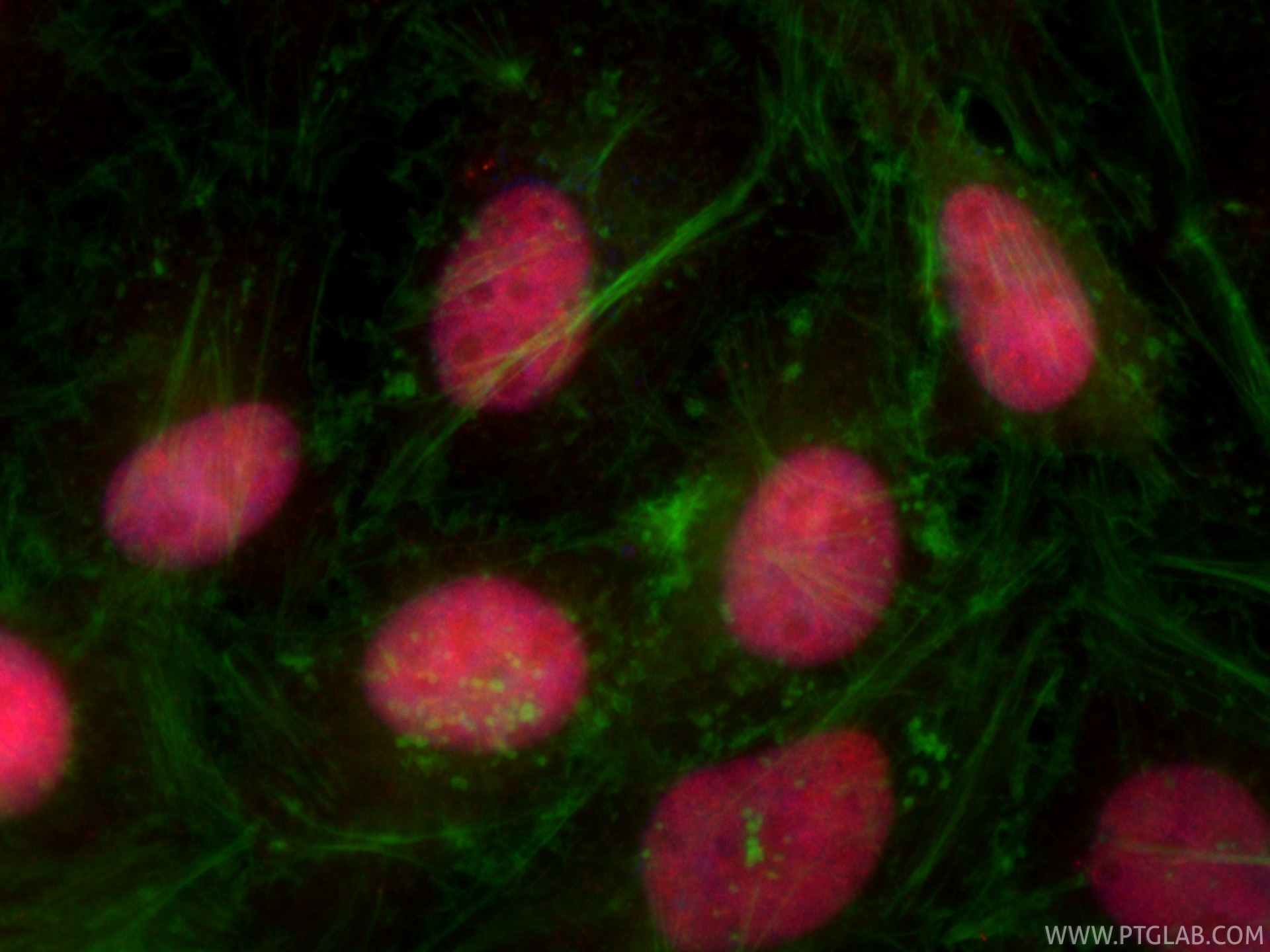 Immunofluorescence (IF) / fluorescent staining of HeLa cells using CoraLite®594-conjugated PCNP Recombinant monoclona (CL594-86075)