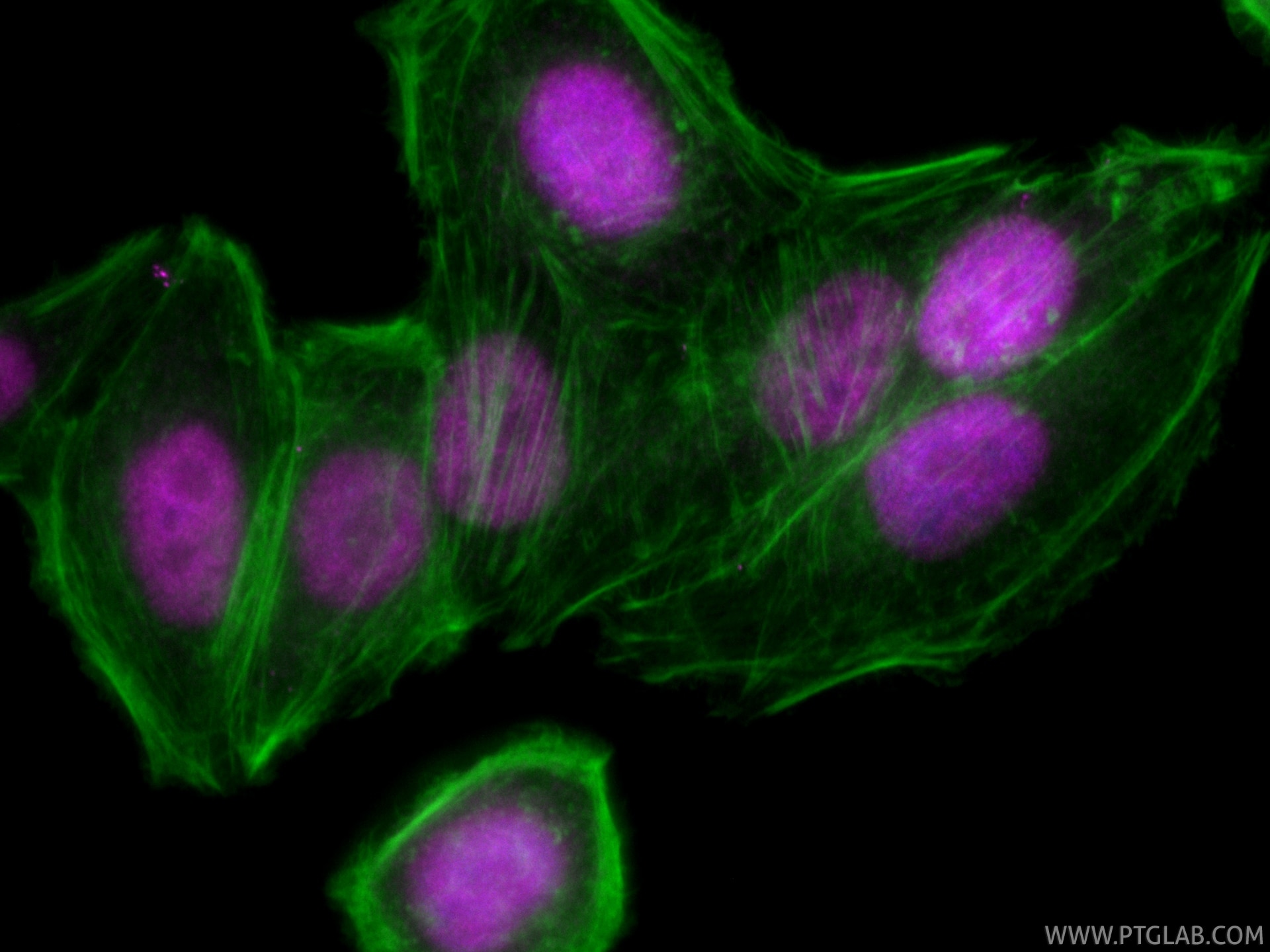 Immunofluorescent analysis of (4% PFA) fixed HepG2 cells using CoraLite® Plus 647 PCNP antibody (CL647-86075, Clone: 250576B6 ) at dilution of 1:200, CL488-phalloidin (green). Immunofluorescence (IF) / fluorescent staining of HepG2 cells using CoraLite® Plus 647-conjugated PCNP Recombinant mon (CL647-86075)
