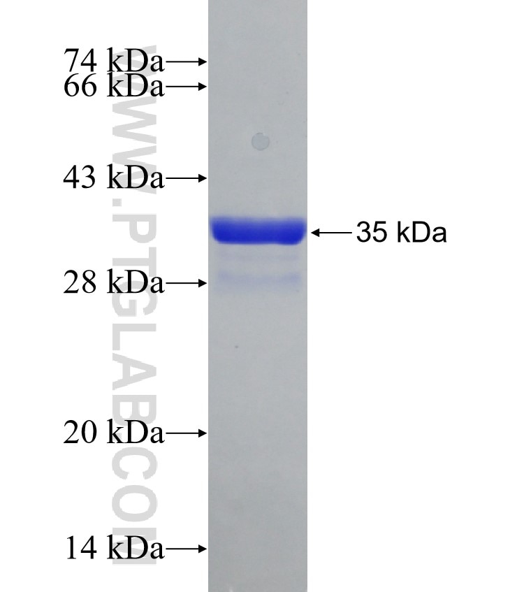 PCNP fusion protein Ag30951 SDS-PAGE