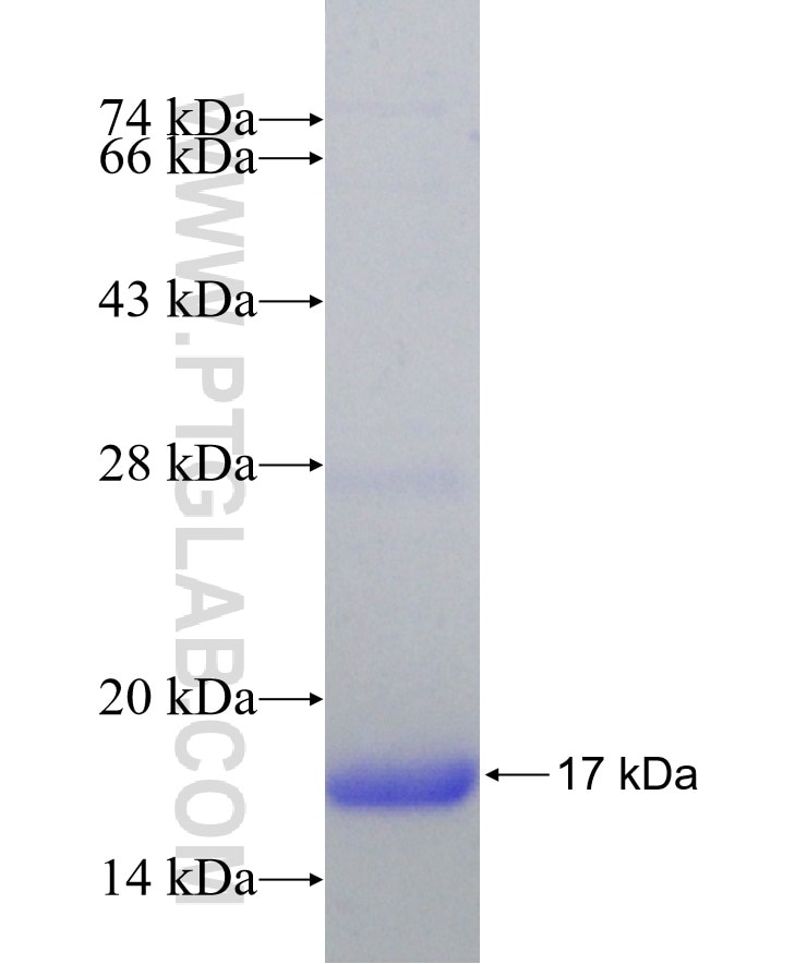 PCNP fusion protein Ag30962 SDS-PAGE PCNP fusion protein Ag30962 SDS-PAGE
